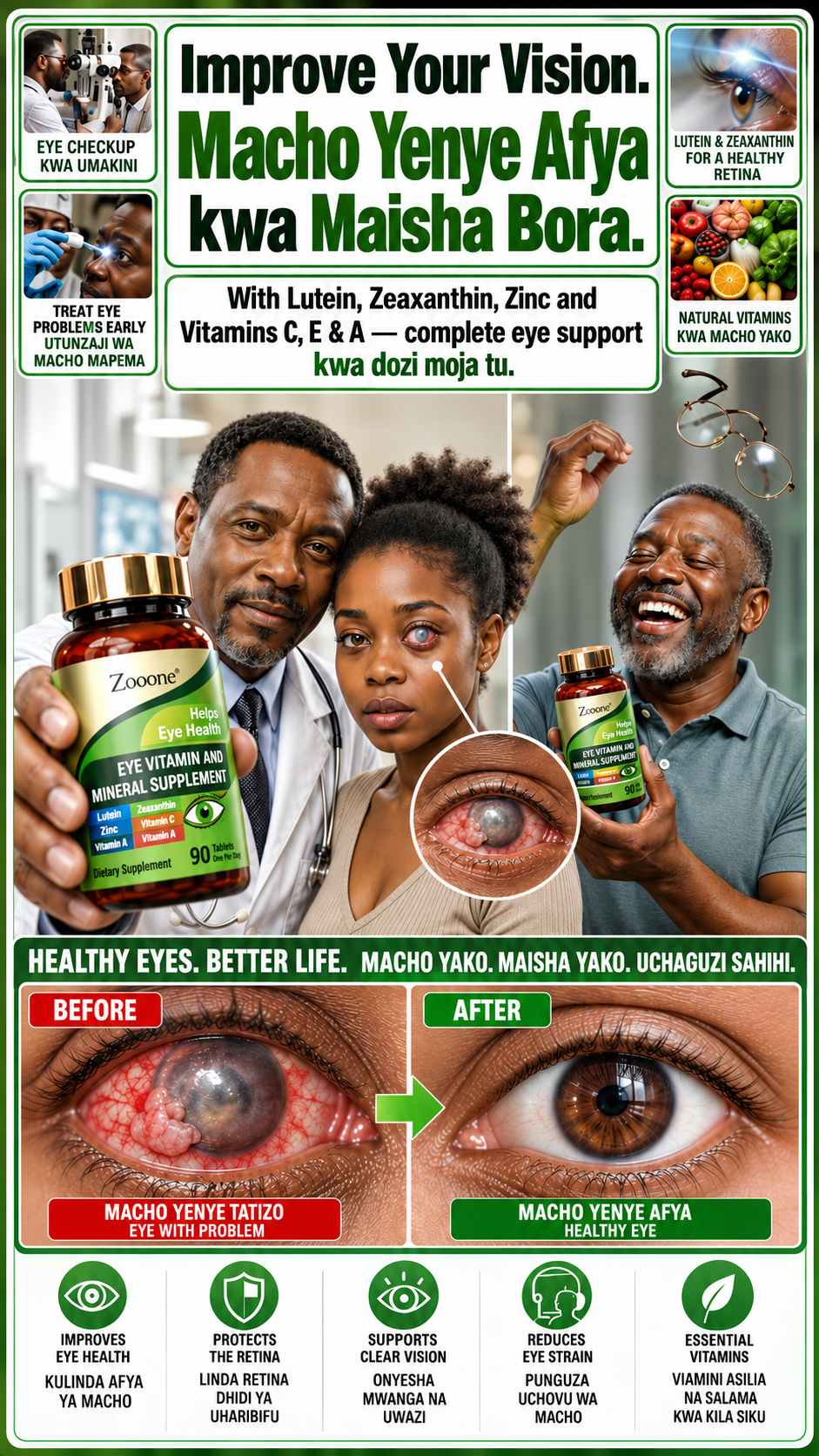 Eye Vitamin : Lutein and Zeaxanthin Supplements